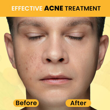 Turmeric Milk Face Serum